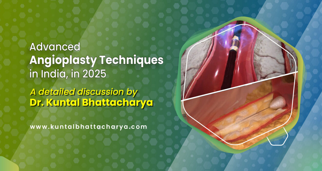 Advanced Angioplasty Techniques by the Best Coronary Angioplasty Doctor in Kolkata