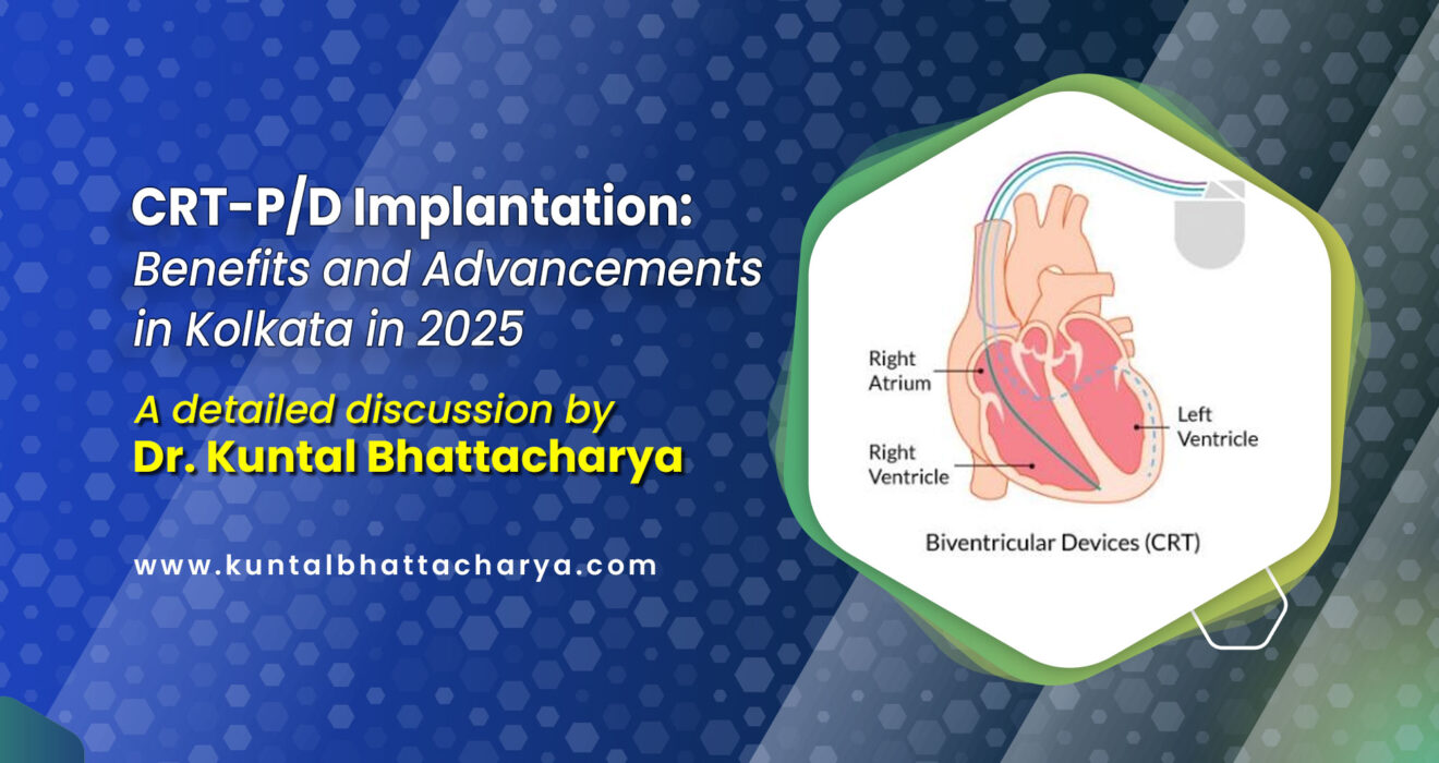 Advancements & Benefits of CRT-P/D Implantation in Kolkata