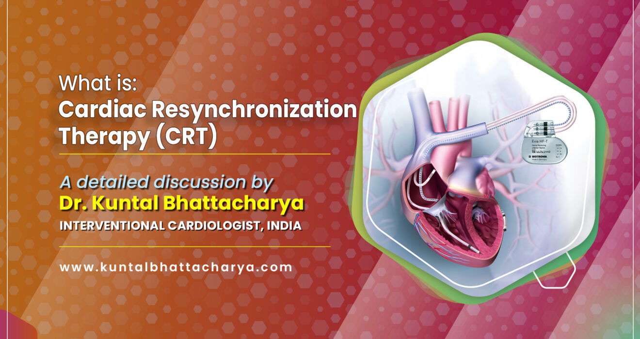 Cardiac Resynchronization Therapy (CRT) in Kolkata: A detailed discussion by Dr. Kuntal Bhattacharya, Interventional Cardiologist in Kolkata, India