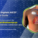 Why do doctors implant AICD? A Simple Guide by Dr. Kuntal Bhattacharya, best doctor in AICD implantation procedure in Kolkata