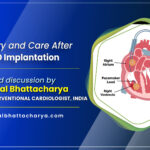 Recovery and Care After CRT-P/D Implantation - Dr. Kuntal Bhattacharya, best cardiac device doctor in Kolkata, India