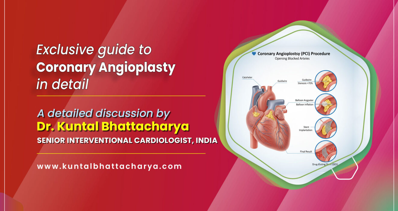 Exclusive Guide to Coronary Angioplasty: An essential Insight from Interventional Cardiologist (PCI) Dr. Kuntal Bhattacharya (Senior), Sr. Heart Specialist Doctor in Kolkata