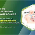 CRT-P vs CRT-D: A Detailed Guide to Understanding the Difference by Dr. Kuntal Bhattacharya, Sr. Consultant Interventional Cardiologist, Kolkata
