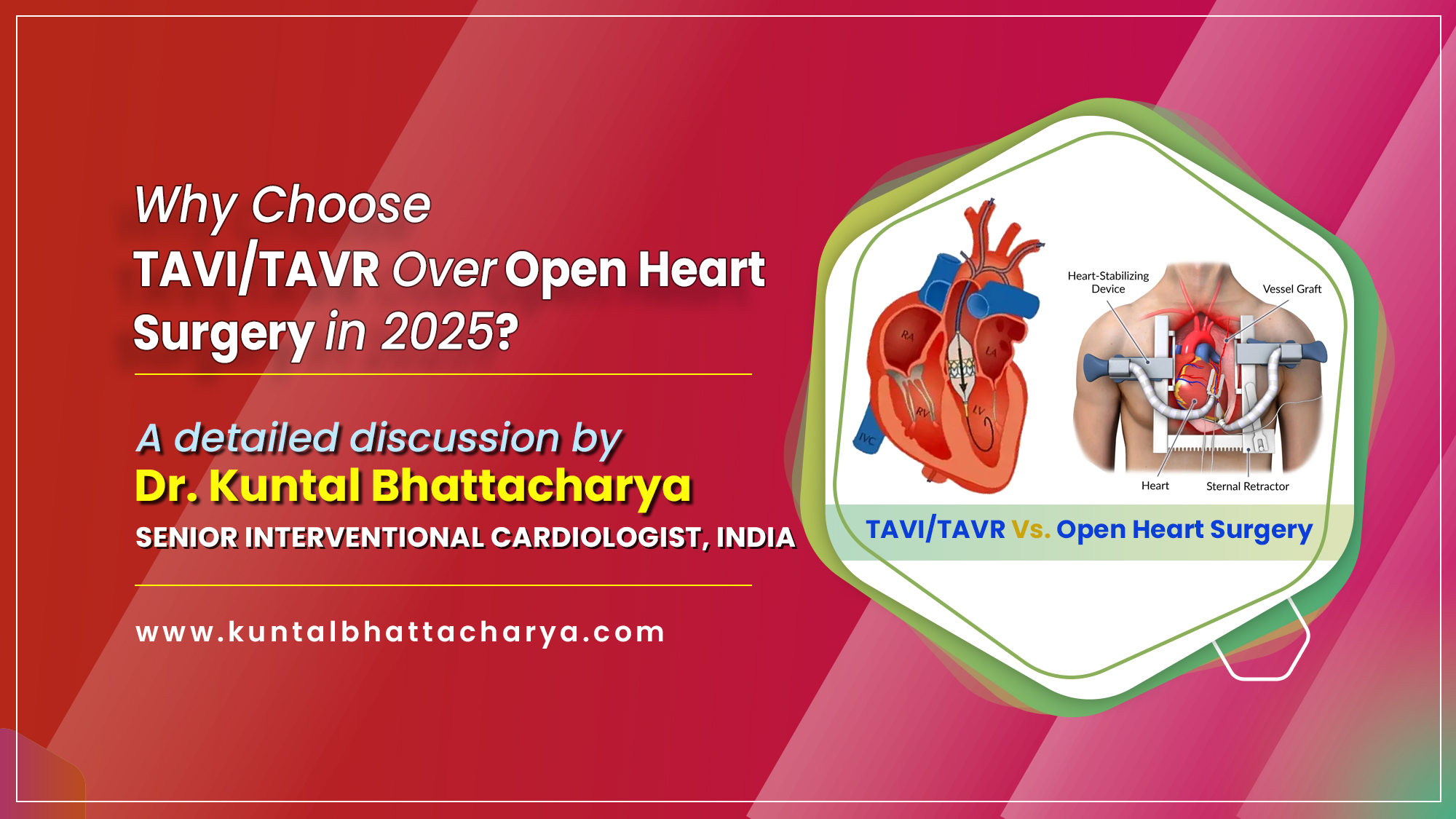 A Comprehensive Guide in 2025 on 